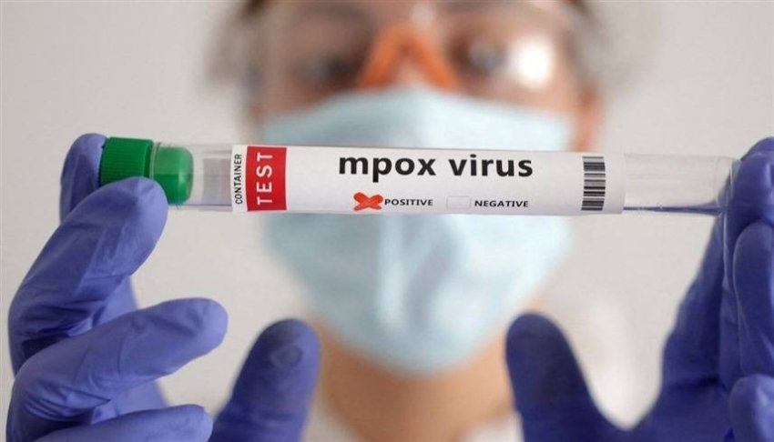 لمواجهة "جدري القرود".. الكاميرون تعلن حالة التأهب القصوى وتفعل أنظمة المراقبة الوبائية