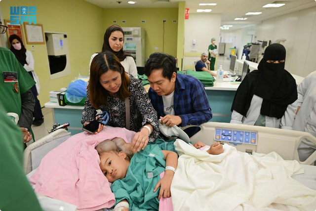 إنفاذًا لتوجيهات خادم الحرمين وولي العهد.. بدء عملية فصل التوأم الملتصق الفلبيني "كليا وموريس آن" في الرياض