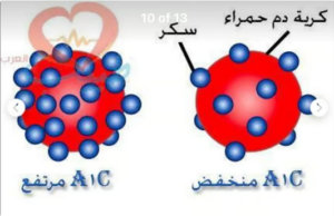 الدكتور فهد الخضيري يحذر من الشائعات الطبية المضللة حول مقاومة الأنسولين والسكري