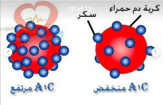 الدكتور فهد الخضيري يحذر من الشائعات الطبية المضللة حول مقاومة الأنسولين والسكري