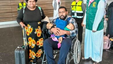 إنفاذًا لتوجيهات خادم الحرمين الشريفين وسمو ولي العهد.. وصول التوأم الملتصق الفيجي "جيسيبيل وديسيسيا"إلى الرياض